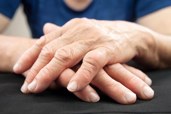 Heart disease fatalities down for rheumatoid arthritis patients