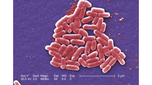 Court Allows Class Action Suit Against Canadian Food Company Over E.Coli