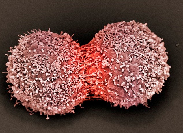 British scientists announce breakthrough achievement in cancer treatment