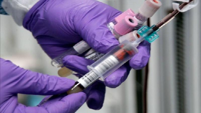 Wisconsin Health Department investigating bloodstream infection outbreak