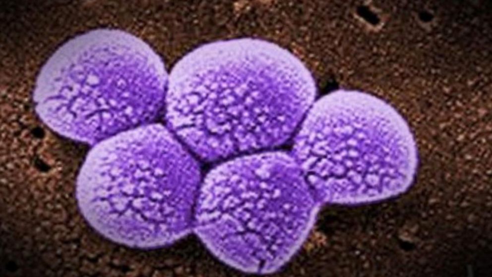 Are Airplane Seats a Ticket to Infection?